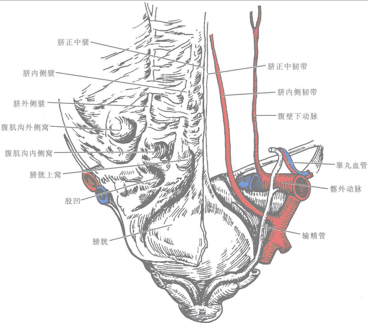 图1-3-23 腹股沟管和海氏三角 (内面)